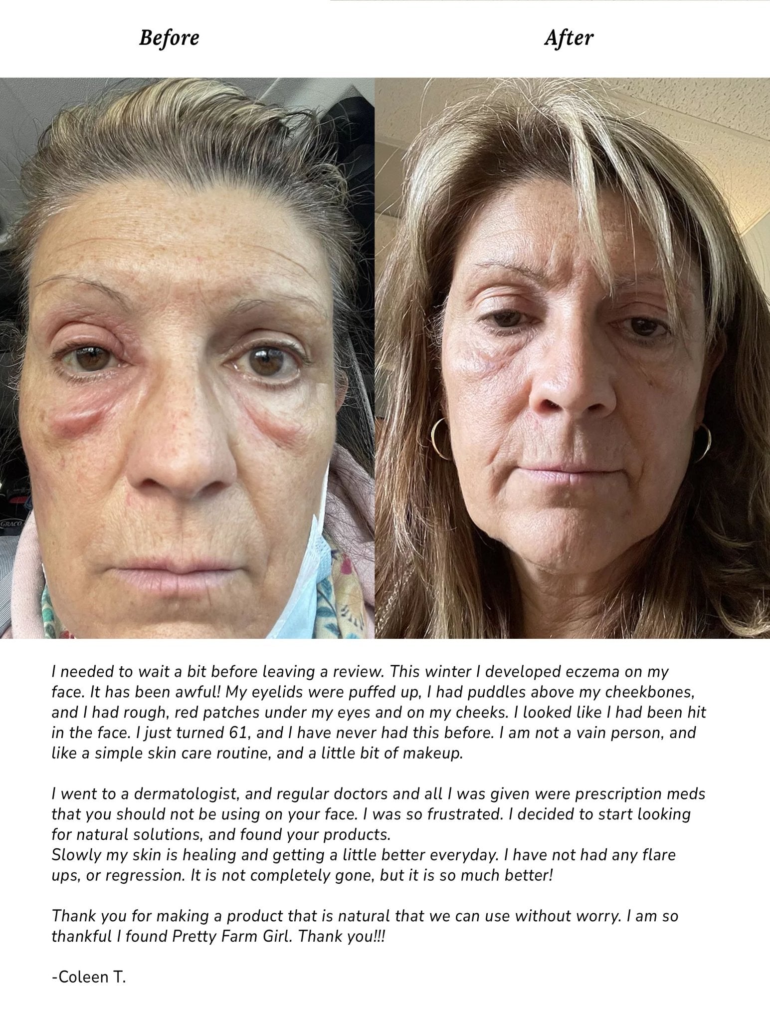 Pure + Simple Skin Kit for Sensitive Skin - Grace & Grit Boutique